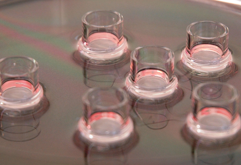 Henkel acquires epiCS skin model technology from SkinInVitro
