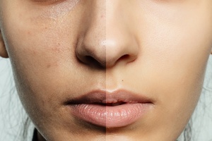 How to avoid a ‘before and after’ image scandal