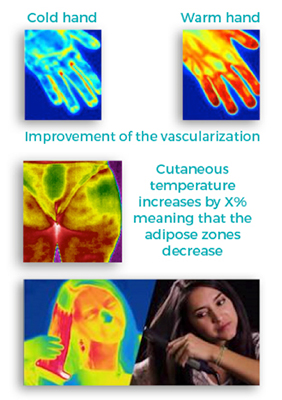 Immediate and contact free evaluation of the skin/hair temperature