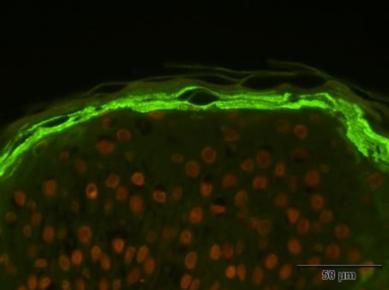 Innovating for atopic dermatitis: Cutting-edge solutions by Eurofins
