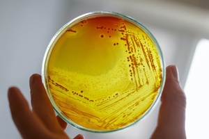L’Oréal recalls Mizani conditioner over contamination fears