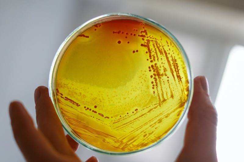 L’Oréal recalls Mizani conditioner over contamination fears