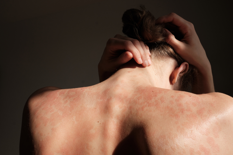 L’Oréal’s dermatology arm launches €20 million skin health programme