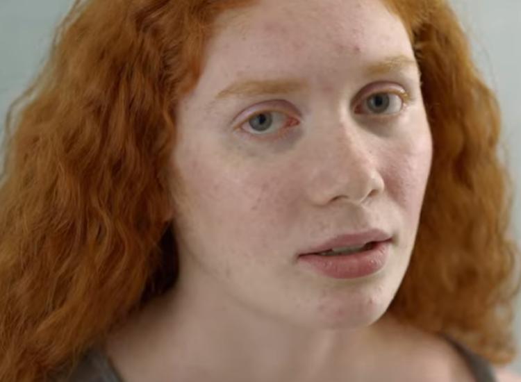 La Roche-Posay highlights impact of skin issues on mental health in first-ever TV brand campaign