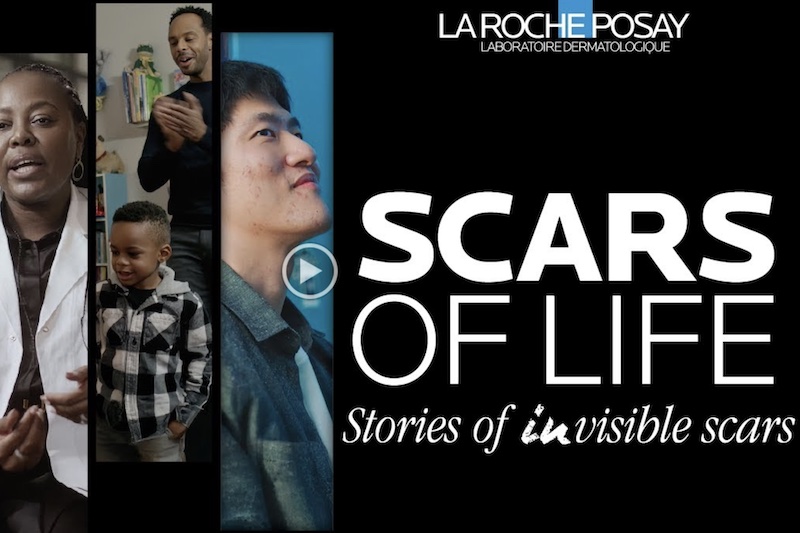 La Roche-Posay tackles emotional impact of scars with debut documentary