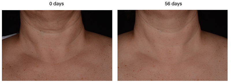 Lipotec launches a new botanical extract for a glamorous décolleté