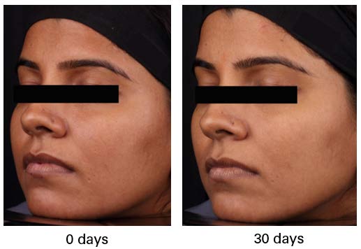 Lipotec’s advanced botanical ingredient demonstrates brightening effect 