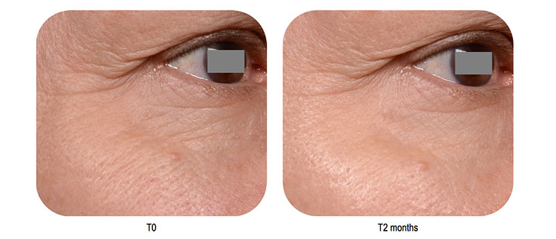 Majestem Drypure: Pure and dry powder for colour cosmetics