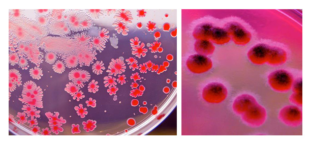 Microbiological quality of cosmetic products