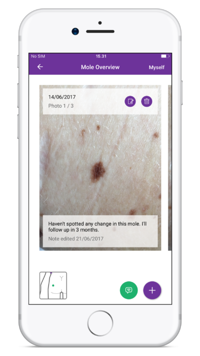 Miiskin receives first-ever accreditation from Skin Health Alliance for dermatology app
