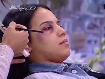 Moroccan state TV apologises for domestic violence make-up tutorial