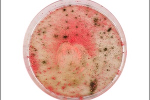 Old make-up found to contain meningitis bacteria