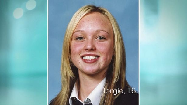 The 16-year-old Porter suffering from acne / Credit: Proactiv