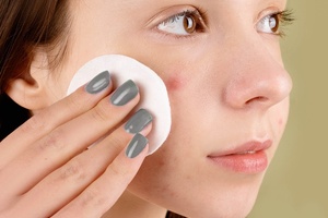 Proactiv Company rebrands as Alchemee as it moves beyond acne
