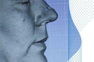 proDerm offers anti-aging claim support 

