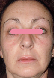 Prodizia by Sederma – prodigiously refreshed skin 