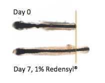 Redensyl - the hair growth galvaniser