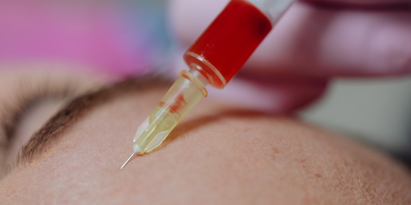 Regulate non-surgical cosmetic procedures within a year, MPs urge UK government 
