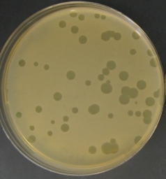 Research finds microbes in skin creams can help fight acne