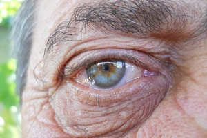 Researchers reveal how fat cells could banish wrinkles 