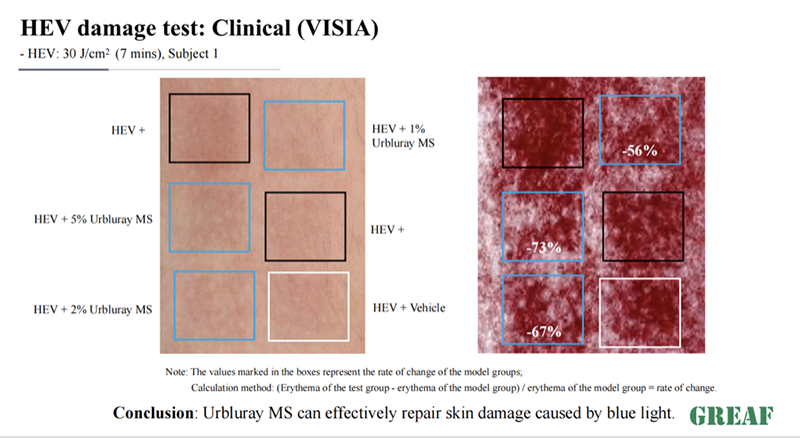 Resist photoaging, Urbluray MS rejuvenates your skin