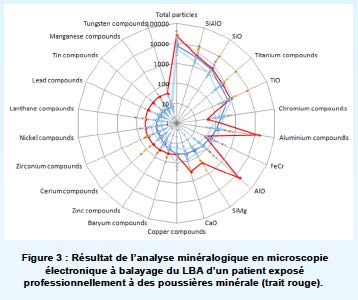 Scientific poster: Mineralogical analysis of Alveolar Bronchiolar Lavage