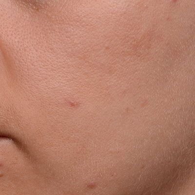 Sederma debuts Crystalide peptide for luminous skin