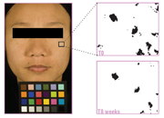 Sederma’s new lightening ingredient complies with Japanese regulations