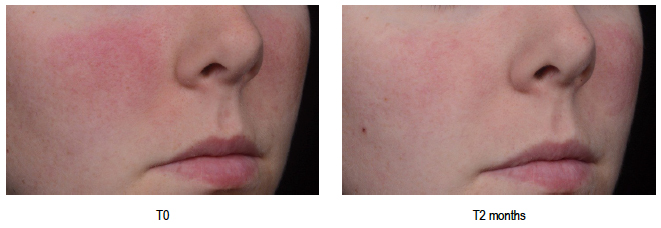 Sederma soothes sensitive skin