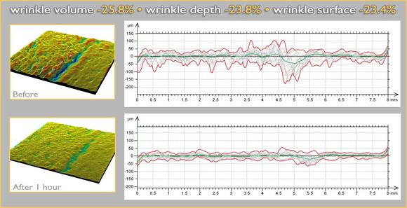 Sederma tightens-up with Dynalift