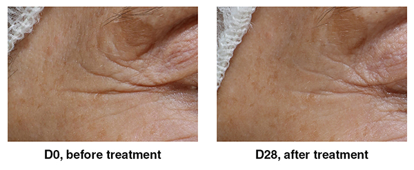 Silab releases additional efficacy data on active ingredient Glyco-Repair
