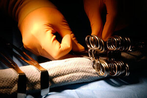 Silimed assures silicone implants are not contaminated
