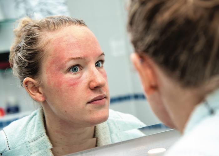 Skin diseases ranked fourth most common illness
