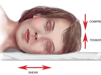 Sleeping on your side or front can cause 'sleep wrinkles'