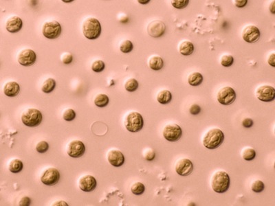 Soliance develops skin soothing ingredient from marine algae