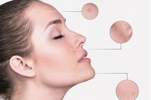 SpecKare C8G: Introducing the latest in skin care ingredients