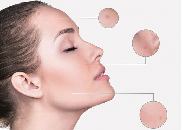 SpecKare C8G: Introducing the latest in skin care ingredients