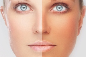 Tanning addicts more likely to be dependent on alcohol 

