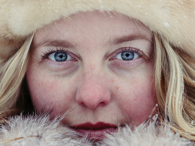 The 4 winter beauty problems consumers are most worried about