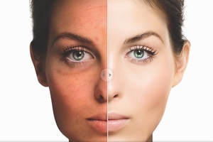 True North coaches consumers with new skin app