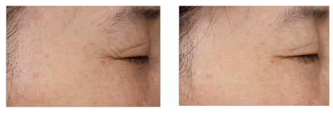 Truly Natural and Safe Ingredients to Human Skin from Regeron