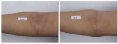 Truly Natural and Safe Ingredients to Human Skin from Regeron