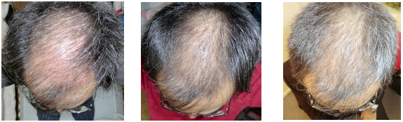 Truly Natural and Safe Ingredients to Human Skin from Regeron
