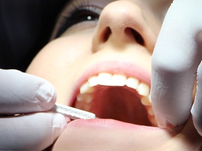 UK pair jailed for selling dangerous teeth whitening kits