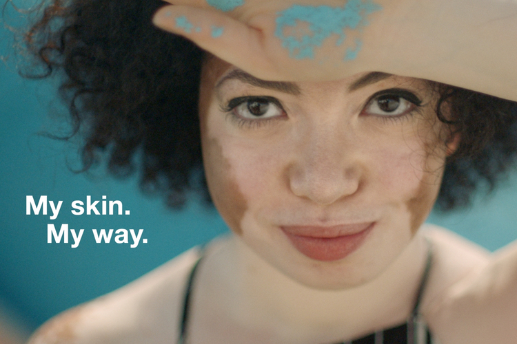 Venus overhauls airbrushed ads and joins body positivity movement 