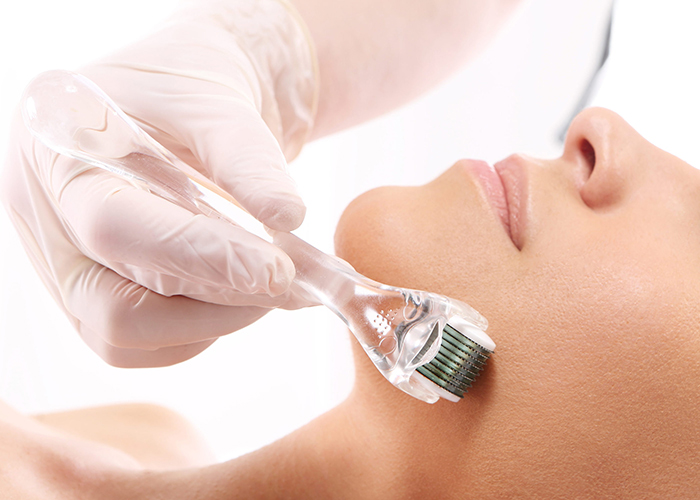 What is microneedling? Cosmetics Business discovers