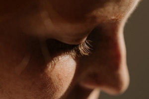 What is photoageing and what can we do to prevent it?
