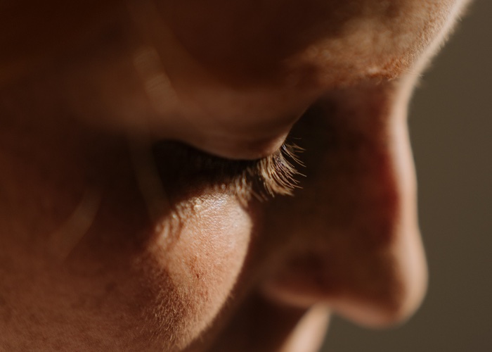What is photoageing and what can we do to prevent it?
