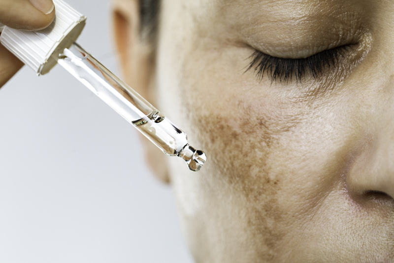 What is tranexamic acid and how does it help pigmentation?