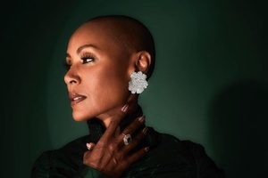 Why the beauty industry has a long way to go before accepting people with alopecia 
